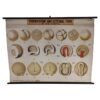 Antique Embryo Educational Wall Chart