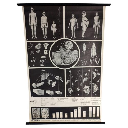Antique Pituitary Gland Wall Chart